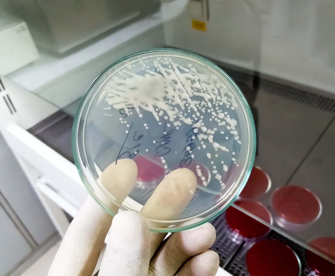 A hand in a latex glove holds a slide with bacteria on it